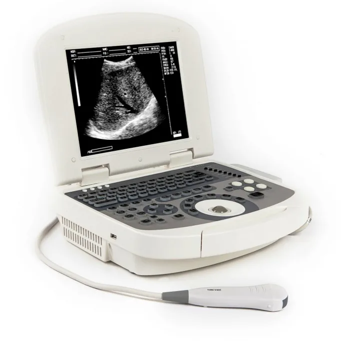 Сканер AcuVista VT98c